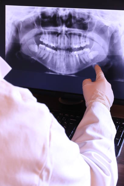Best Emergency Dental Extractions in Ellsworth, ME